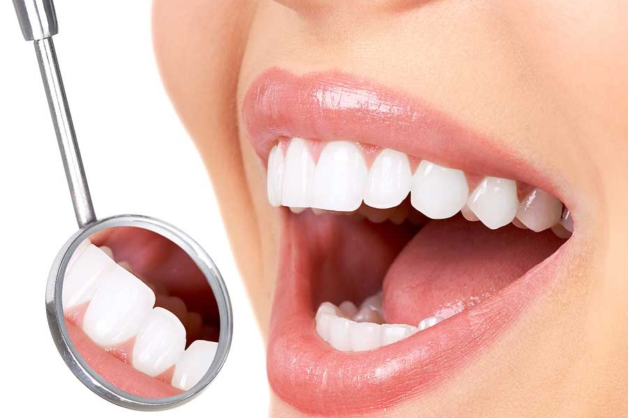Woman smiling and showing a closeup of her teeth
