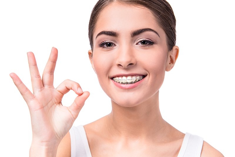 woman with white clear ceramic braces