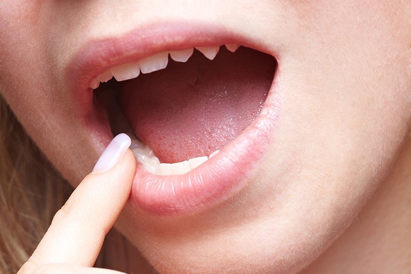 Young woman at dentist